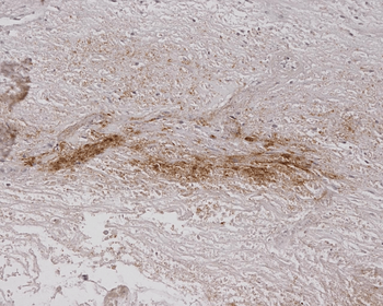 Alginate Antibody: PerCP