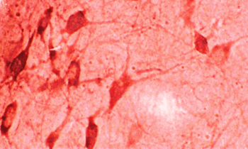 HO-1 Antibody: HRP