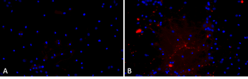 Alpha Synuclein A53T Mutant Pre-formed Fibrils (Type 1)
