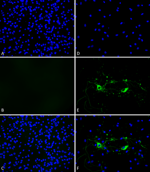 Alpha Synuclein Pre-formed Fibrils (Type 1)