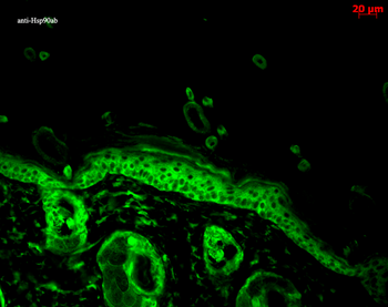 HSP90 alpha/beta Antibody