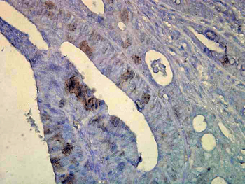 HSP70 Antibody (FITC)
