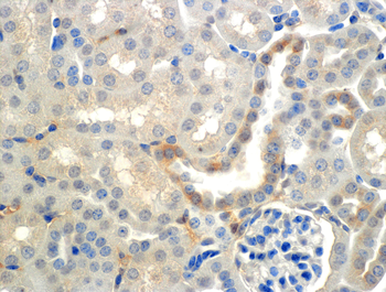ENaC beta Antibody: HRP