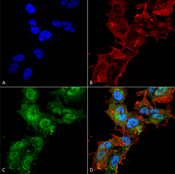 Calcium Sensing Receptor Antibody: FITC