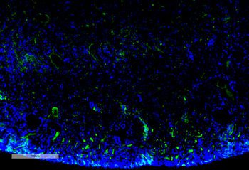 Malondialdehyde Antibody: Biotin