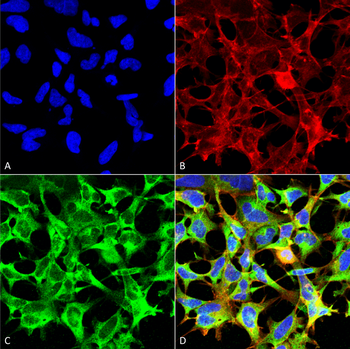 Sulfotyrosine Antibody: HRP