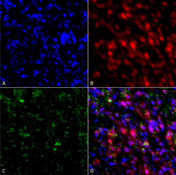 Alpha Synuclein Antibody (RPE)