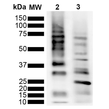 Ubiquitin Antibody: APC
