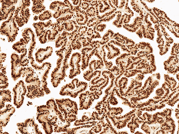 Wnt5a Antibody: APC