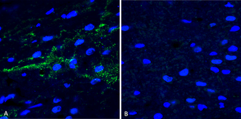 Alpha Synuclein Antibody (pSer129): RPE
