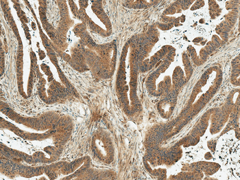 MDM2 Antibody: HRP