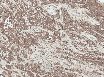SFRP2 Antibody: Biotin