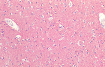 Tau Antibody: FITC