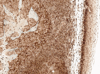 CCR2 Antibody: FITC