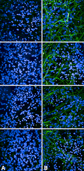 Tau Antibody (pSer202/ pThr205)