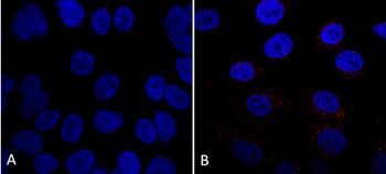 VPS35 Antibody: RPE