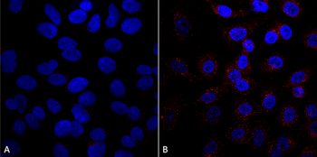 VPS35 Antibody: RPE