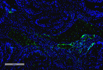 VPS35 Antibody: RPE