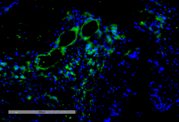 VPS35 Antibody: PerCP