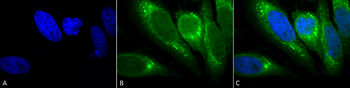 GRP78 Antibody