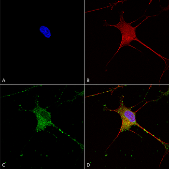 SUR1 Antibody