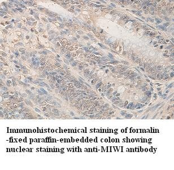 PIWIL2 Rabbit Polyclonal Antibody