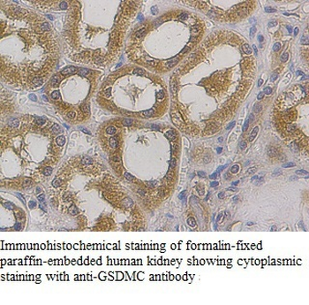 GSDMC Rabbit Polyclonal Antibody