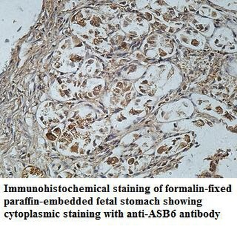 ASB6 Rabbit Polyclonal Antibody