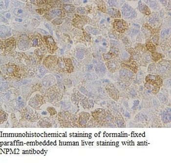 NPM2 Rabbit Polyclonal Antibody