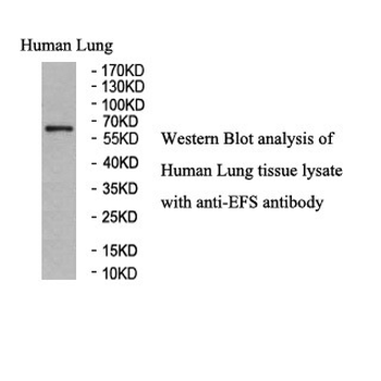 EFS Rabbit Polyclonal Antibody