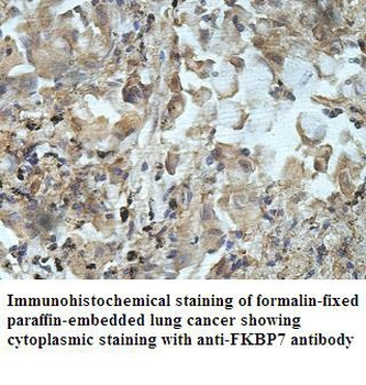FKBP7 Rabbit Polyclonal Antibody