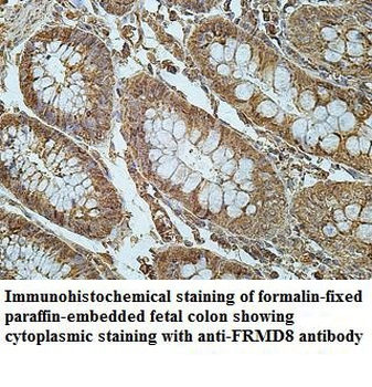 FRMD8 Rabbit Polyclonal Antibody
