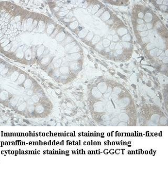GGCT Rabbit Polyclonal Antibody