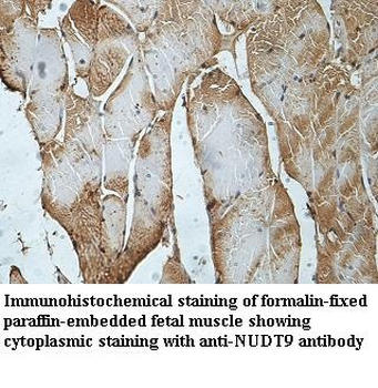 NUDT9 Rabbit Polyclonal Antibody