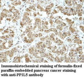 PPIL5 Rabbit Polyclonal Antibody