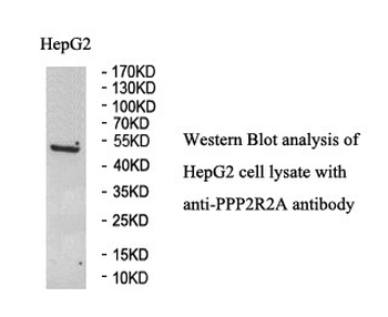 PPP2R2A Rabbit Polyclonal Antibody