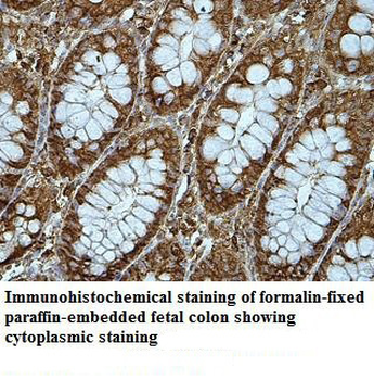 WDR51A Rabbit Polyclonal Antibody