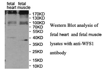 WFS1 Rabbit Polyclonal Antibody