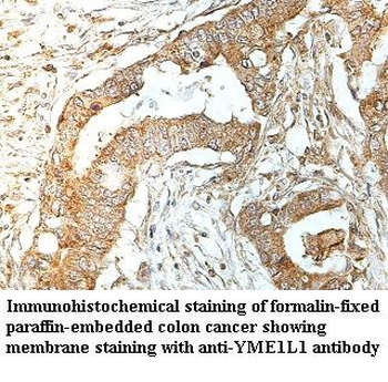 YME1L1 Rabbit Polyclonal Antibody