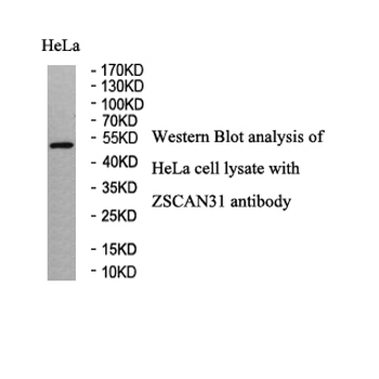 ZNF323 Rabbit Polyclonal Antibody