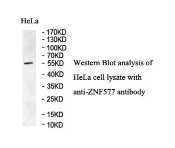 ZNF577 Rabbit Polyclonal Antibody