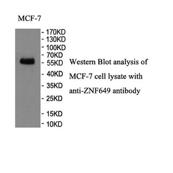 ZNF649 Rabbit Polyclonal Antibody