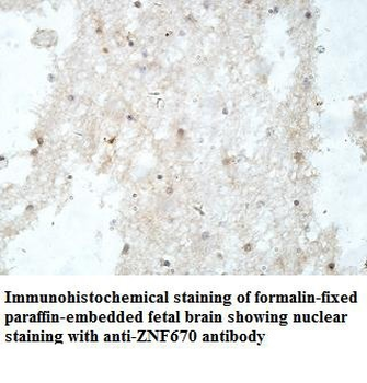 ZNF670 Rabbit Polyclonal Antibody