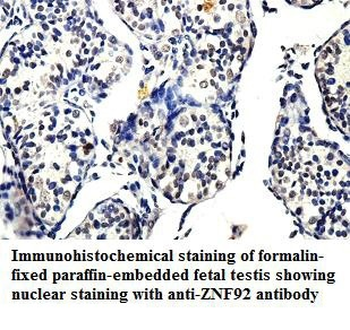 ZNF92 Rabbit Polyclonal Antibody