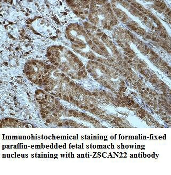 ZSCAN22 Rabbit Polyclonal Antibody