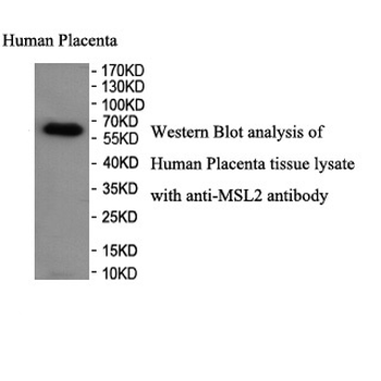 MSL2 Rabbit Polyclonal Antibody