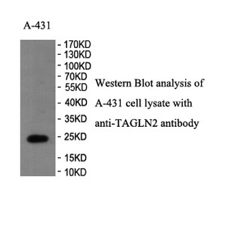TAGLN2 Rabbit Polyclonal Antibody