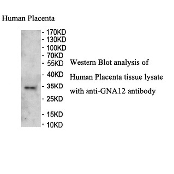 GNA12 Rabbit Polyclonal Antibody