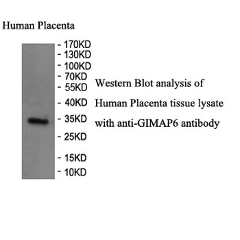 GIMAP6 Rabbit Polyclonal Antibody