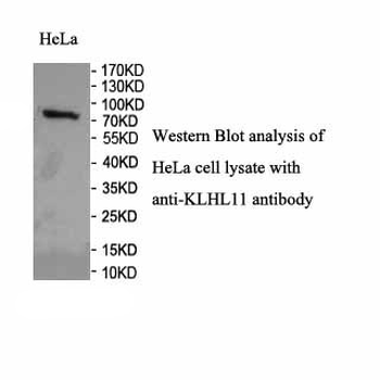 KLHL11 Rabbit Polyclonal Antibody